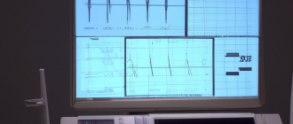 How does an EKG machine work?