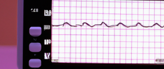 How does a pacemaker regulate heart rate?