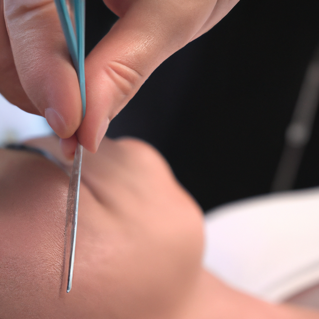 What are the benefits of acupuncture?